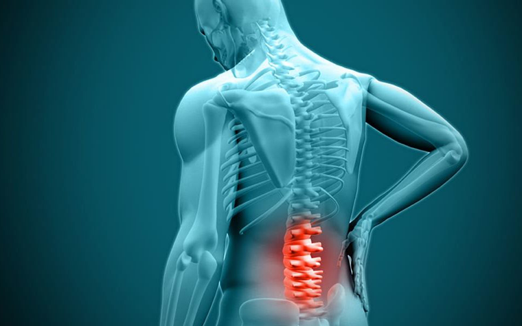 Como é uma cirurgia para hérnia de disco?