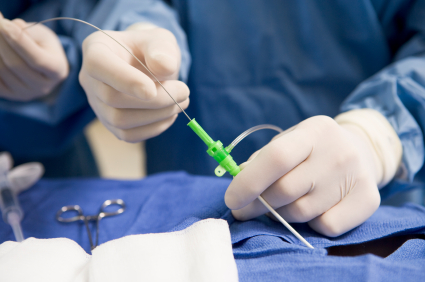 Técnicas minimamente invasivas: o que são, como funcionam e quais as vantagens?